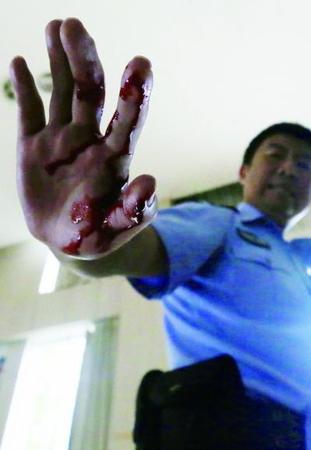 　由于培训全是真刀真枪，一民警的手被“匪徒”砍伤 摄 法制晚报记者 曹博远