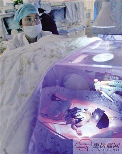 11月17日，西南医院儿科监护室，23周的早产儿“筷子宝宝”在保温箱里接受治疗。 （资料图片）重庆晨报记者 雷键 摄