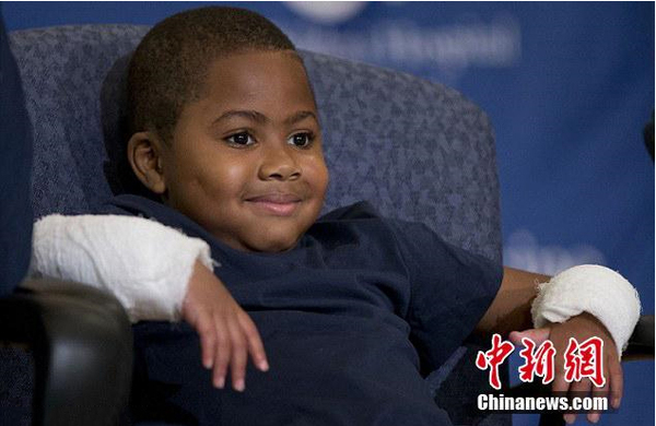 美国8岁男孩成功移植双手-为年龄最小案例2