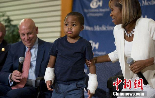 美国8岁男孩成功移植双手-为年龄最小案例5