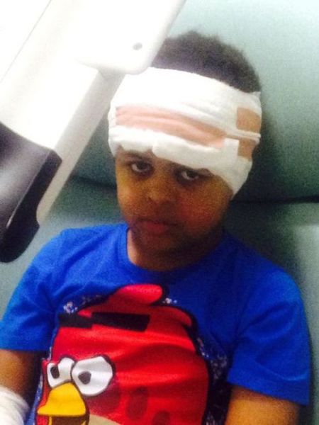 英国一9岁男孩患罕见疾病:大脑长在了脖子里