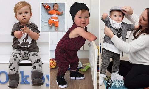　英国一名14个月大的“独臂宝宝”奥克利·林奇近日收获了大批粉丝。