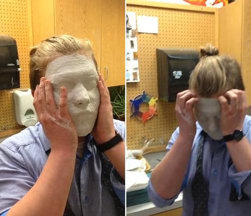 美国学生错误使用石膏面具无法摘除。