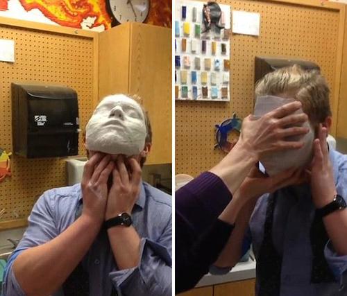 美国学生错误使用石膏面具无法摘除。