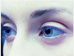 青光眼应早期控制 不近视的人也可能患病