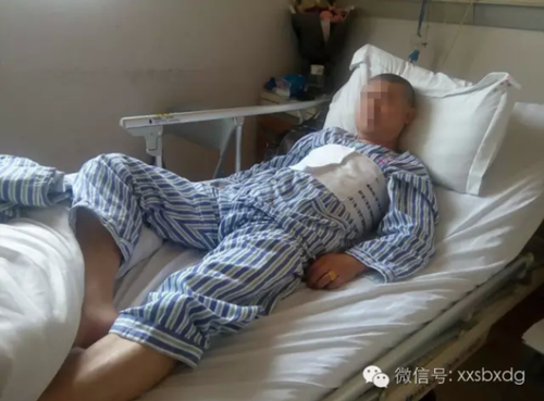 广东一男子未带身份证 被民警打断7根肋骨