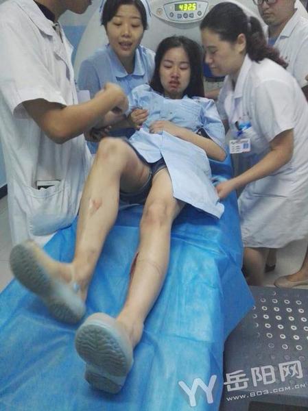 救护车遭车祸 女护士口鼻流血救病人