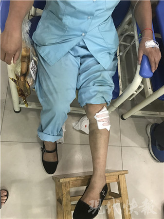 南京一野猪闯进医院 保洁员小腿被咬穿伤口撕裂