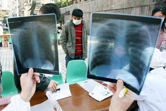 最新呼吸病流行状况研究：我国慢阻肺患者近1亿