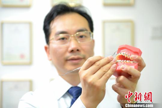 箍牙不再担心划伤广州医生研发球面牙齿矫正托槽
