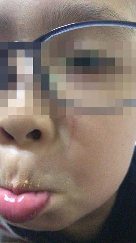 上海幼儿园多名孩子被划伤 疑似保育员所为
