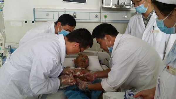 云南省中医医院医疗队在救治伤员