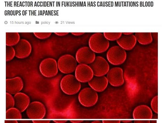 俄媒：日本出现两种新血型 科学家称或与福岛核事故有关
