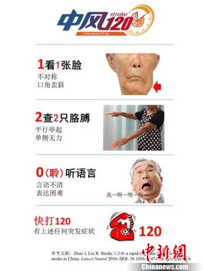 中国十省市多点协同发布短视频呼吁警惕房颤引发中风