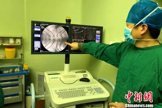 国产骨科手术机器人“天玑”3日在安徽医科大学第一附属医院完成“首秀”。　张强 摄