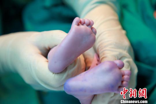 世界首例“线粒体移植婴儿”广州出院