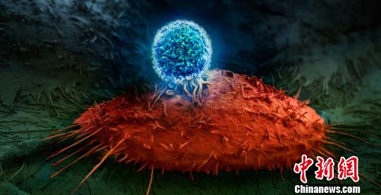 电子显微镜下，ET140202 T细胞正在攻击肝癌细胞。　钟欣 摄