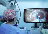 全国首台强生眼力健TECNIS® Toric II植入手术成功开展